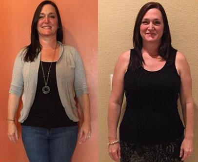 Katie Ramsey Before & After